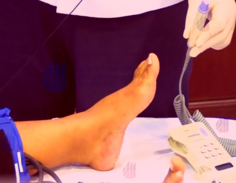 Medición de índice tobillo-brazo